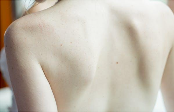 How Can a Simple Backache Lead to Major Spine Issues?