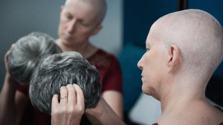 Wigging Out? What You Need to Know About Medicare and Cancer Treatment Hair Loss