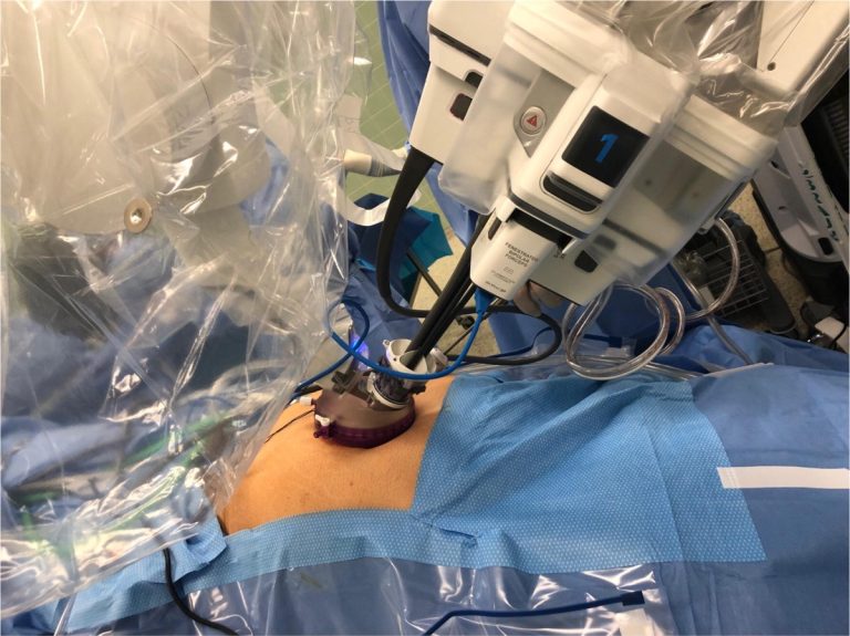 The Evolution of Minimally Invasive Therapeutics: Single-Port Robotic Assisted Surgery